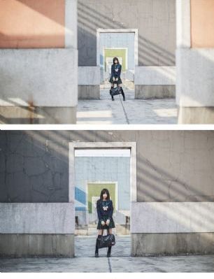 根管治疗